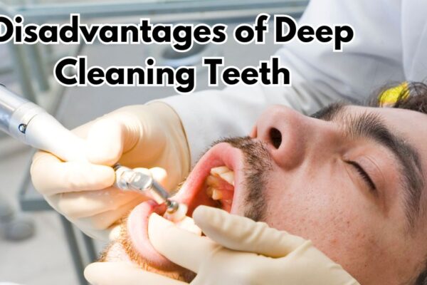 Disadvantages of Deep Cleaning Teeth