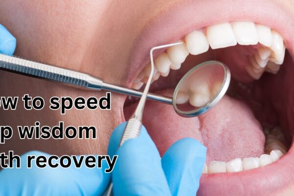 How to speed up wisdom teeth recovery