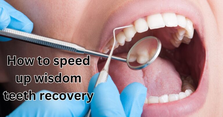 How to speed up wisdom teeth recovery