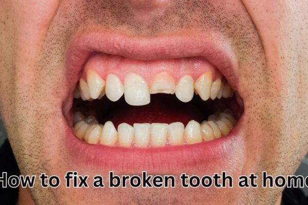 how to fix a broken tooth at home