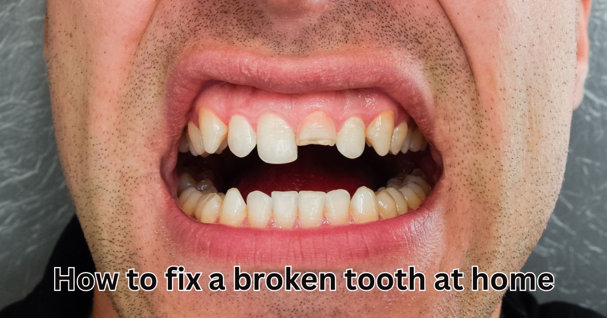 how to fix a broken tooth at home