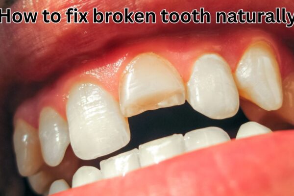 how to fix broken tooth naturally