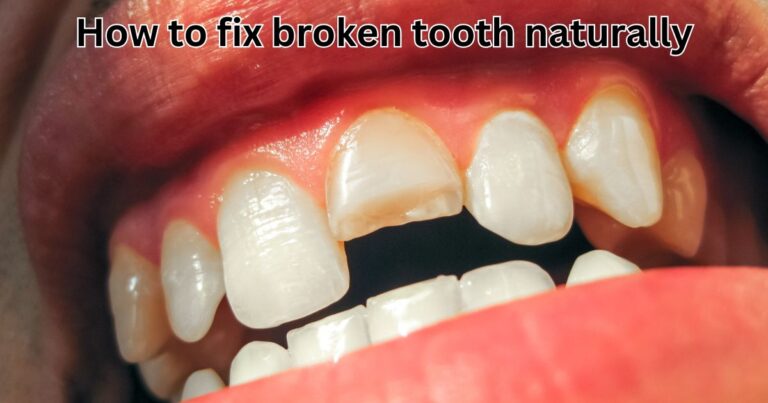 how to fix broken tooth naturally